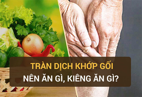 Tràn dịch khớp gối nên ăn gì, kiêng gì và cách điều trị bệnh dứt điểm - 1