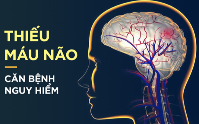 Rối loạn tiền đình, đau đầu, mất ngủ, nhức chân tay: Thử mẹo này đi bao thoát bệnh, từ nay ngủ khỏe ăn ngon! - 1