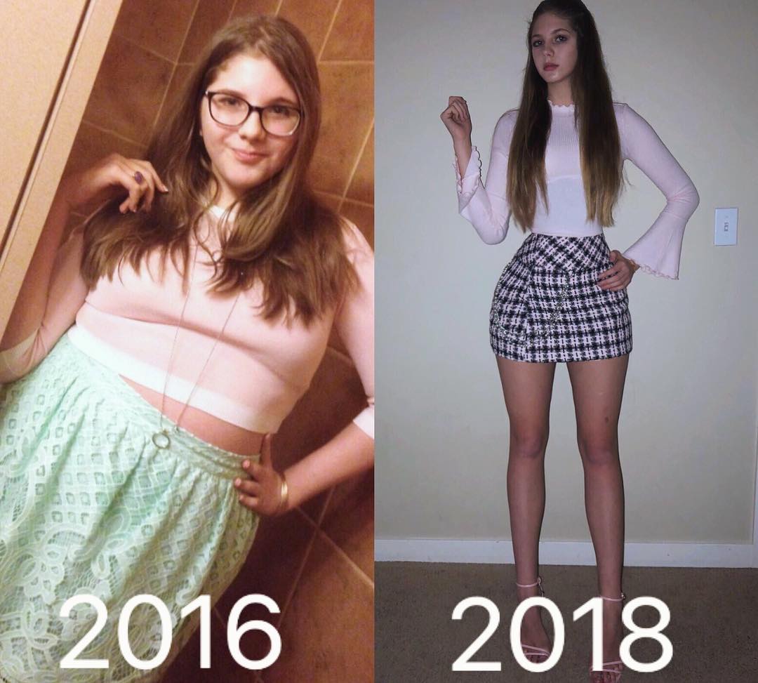 The 18 Year Old Russian Girl Weighs Nearly 100 Kg Losing Weight