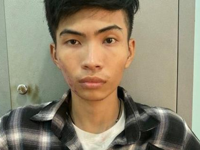 Pháp luật - Bắt đối tượng đổ xăng đốt thiếu nữ 15 tuổi tử vong