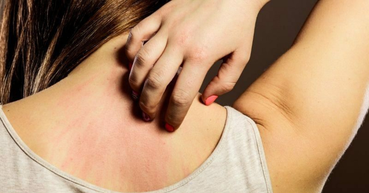 Sức khỏe đời sống - Không thể ngờ những dấu hiệu ngứa 'vặt vãnh' này lại cảnh báo có thể bạn mắc ung thư