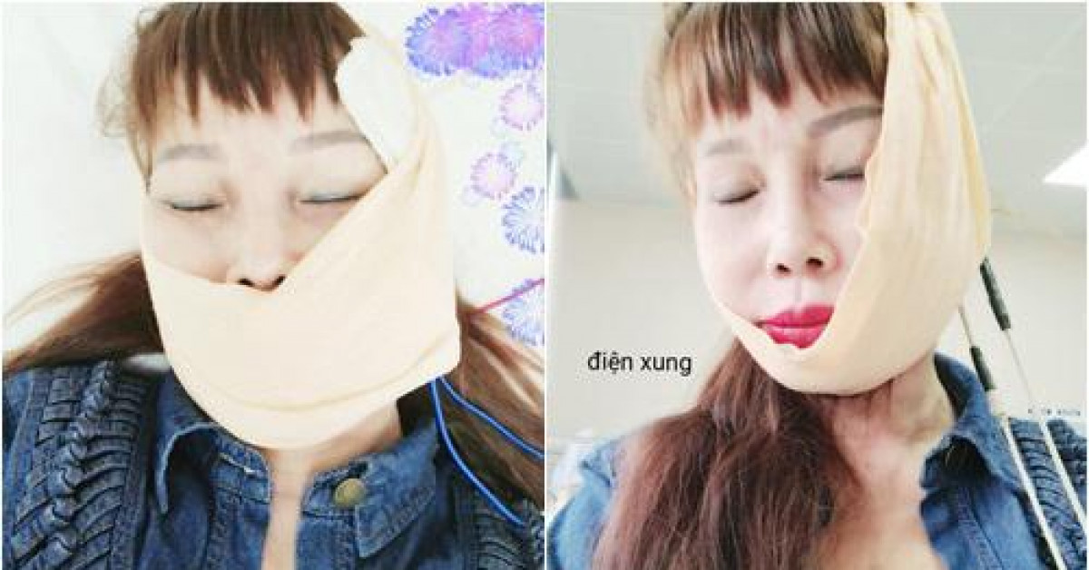 Bạn trẻ - Cuộc sống - Sau màn dao kéo nâng cơ mặt, “cô dâu 62 tuổi” gây hoang mang vì suýt "méo miệng"