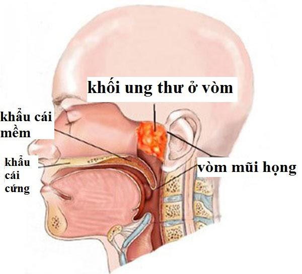 Đây là món cá nhiều người ưa thích được WHO xếp vào nhóm gây ung thư số 1, hãy dừng ăn ngay nếu không muốn mắc ung thư - 4