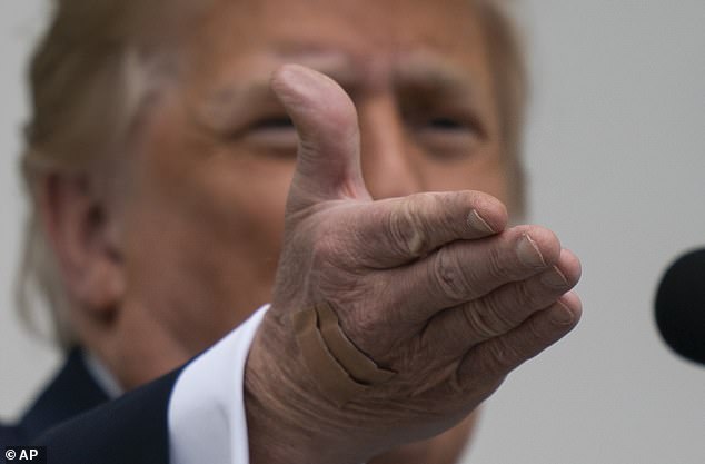 Dấu hiệu lạ ở bàn tay phải của ông Trump.