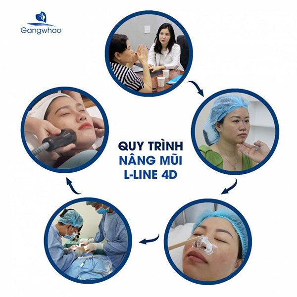 Thẩm mỹ viện Gangwhoo nâng mũi L–Line hóa “soái ca” - 7