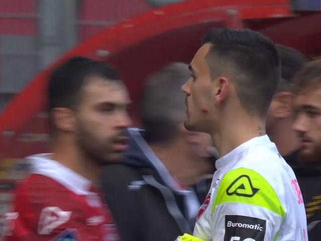 Bóng đá - SAO bóng đá Pháp hóa "Suarez 2.0" cắn đối thủ, sắp có án phạt nặng