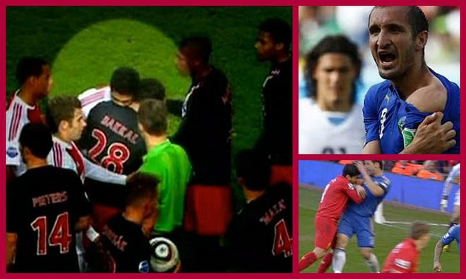 SAO bóng đá Pháp hóa "Suarez 2.0" cắn đối thủ, sắp có án phạt nặng - 2