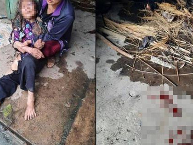 Pháp luật - Công an thông tin chính thức vụ bà cụ 90 tuổi bị thiêu sống, cướp tài sản