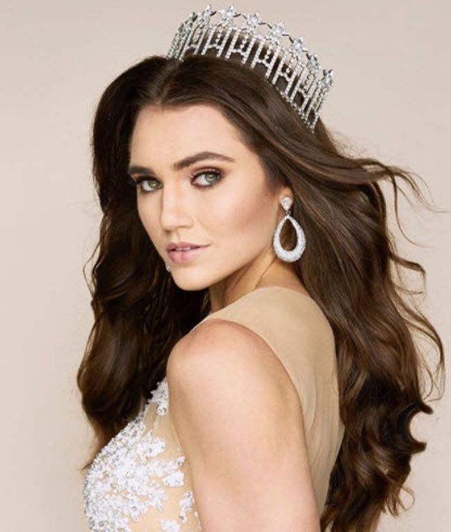 Alexis Lete đăng quang Miss Indiana USA 2020, một dấu mốc chứng minh sự tỏa sáng rực rỡ của người đẹp bóng chuyền.
