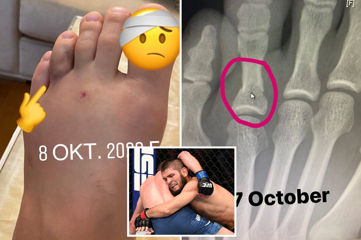 Khabib đã làm tất cả để có một chiến thắng nhẹ nhàng trước khi giải nghệ