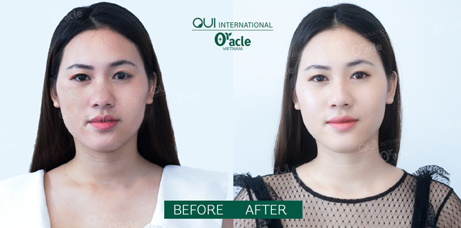 Bio-Whitening – “vắc-xin” phòng ngừa lão hóa sớm cho da - 5