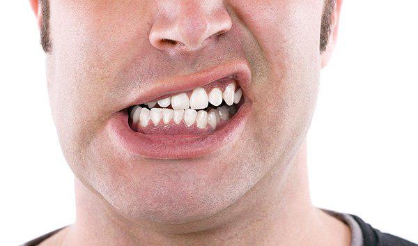 7 thói quen hủy hoại hàm răng mà nhiều người vẫn vô tư làm hằng ngày - 4