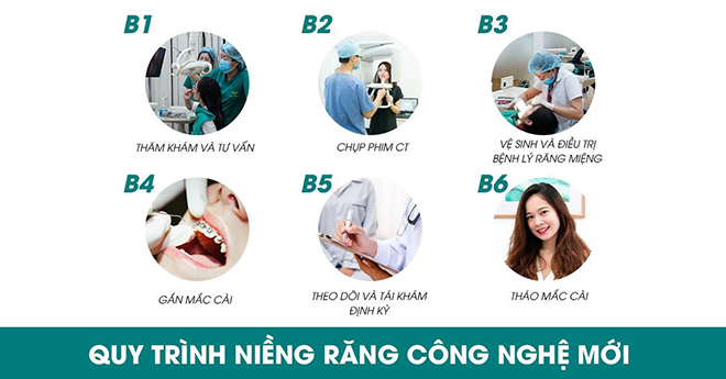 Niềng răng công nghệ mới hiệu quả tối đa, thời gian tối thiểu tại Queen Smile - 1