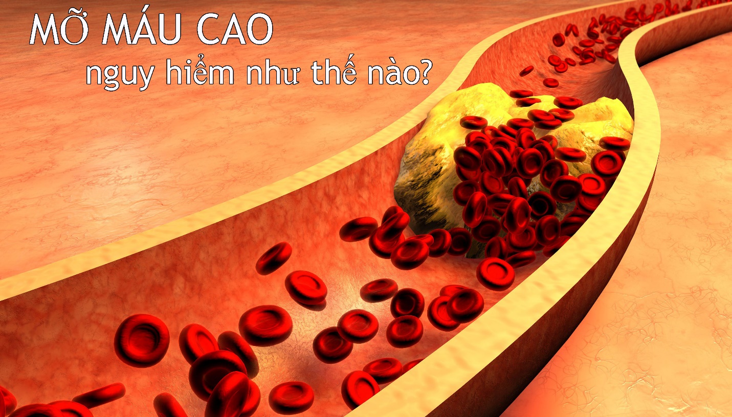 Bệnh máu nhiễm mỡ có nguy hiểm không? Bệnh máu nhiễm mỡ có nguy hiểm không?