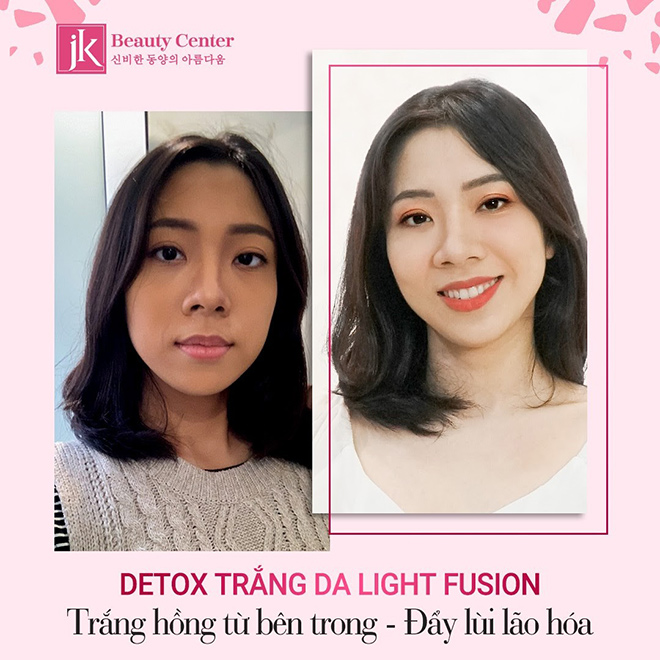 Detox trắng da- Light Fusion tái tạo làn da trắng hồng không tì vết  - 3
