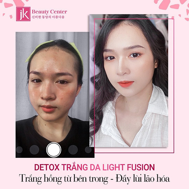 Detox trắng da- Light Fusion tái tạo làn da trắng hồng không tì vết  - 4