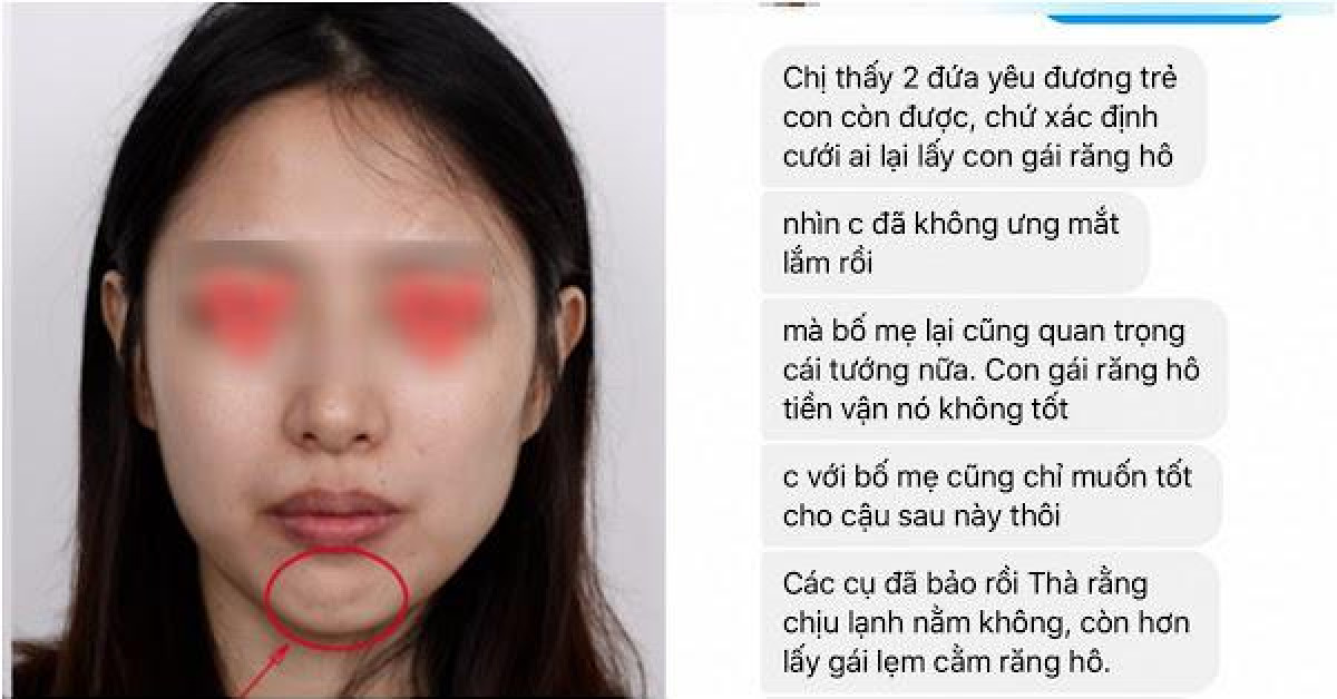 Bạn trẻ - Cuộc sống - Về ra mắt, cô gái giận "tím người" khi biết lý do khiến nhà trai bỗng nhiên "mặt lạnh"