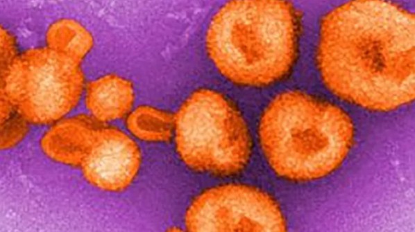 Mỹ: COVID-19 đang 'nóng sùng sục', lại phát hiện thêm virus cực độc - 2