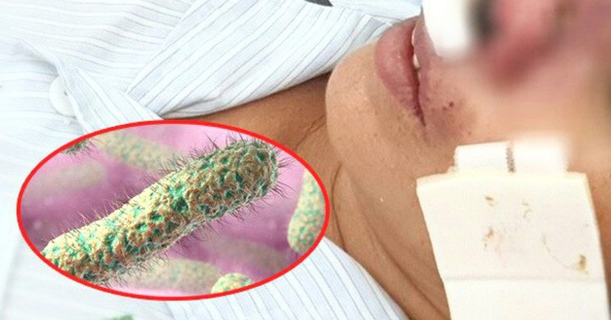 Tin tức trong ngày - Quảng Trị: 9 bệnh nhân mắc bệnh ‘vi khuẩn ăn thịt người’ Whitmore