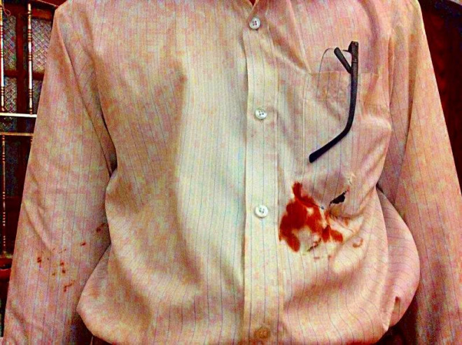 Ông Mười bị nhiều vết thương, trong đó có một vết thương ở ngực trái.&nbsp;