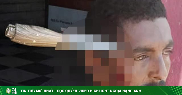 Người đàn ông bị bắn 7 phát đạn, 3 năm sau bị dao đâm xuyên đầu
