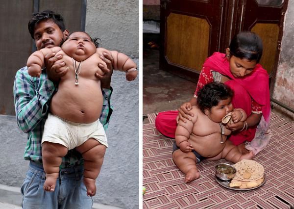 Chahat thường xuyên đòi ăn, rất khác so với những đứa trẻ thông thường. 