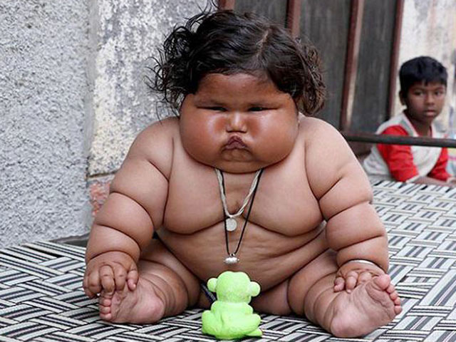 Bạn trẻ - Cuộc sống - Cuộc sống của "bé gái béo nhất thế giới" gây ngỡ ngàng 3 năm trước giờ ra sao?