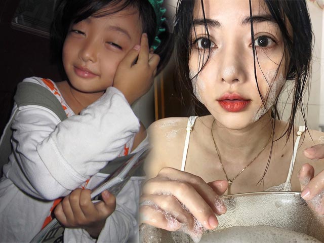 Làm đẹp - Cô gái Việt "trổ mã" hậu dậy thì xinh đẹp như Địch Lệ Nhiệt Ba nhờ hàm "răng sắt"