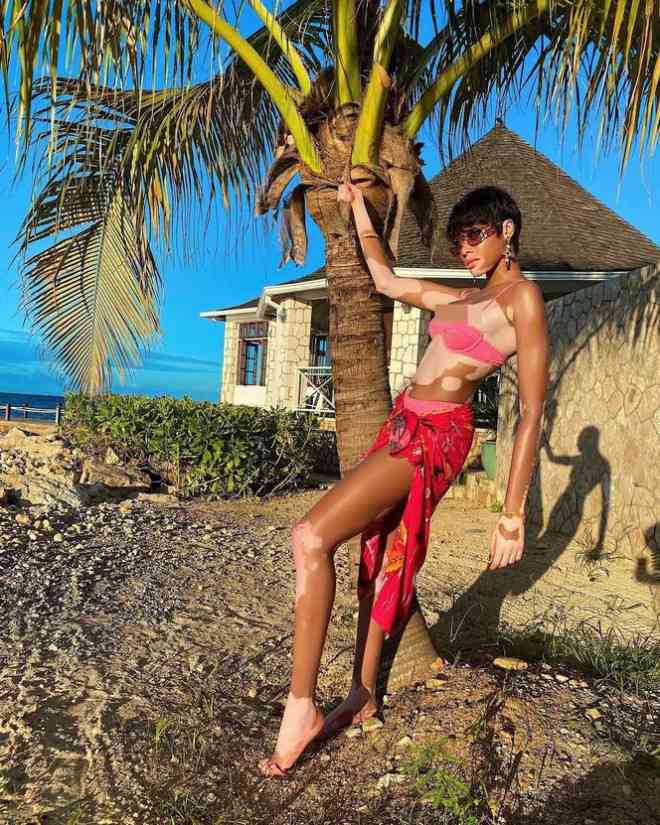 Winnie Harlow quyến rũ hút hồn giữa biển tuyệt đẹp ở Jamaica - 4