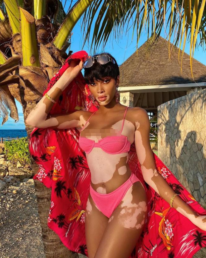 Winnie Harlow quyến rũ hút hồn giữa biển tuyệt đẹp ở Jamaica - 2