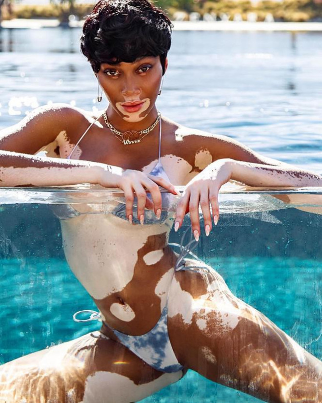 Winnie Harlow quyến rũ hút hồn giữa biển tuyệt đẹp ở Jamaica - 7