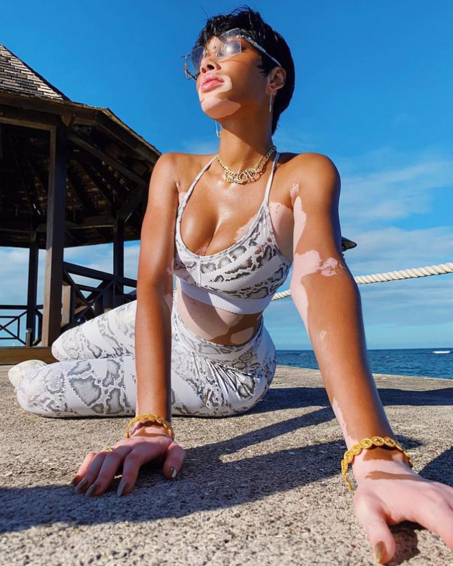 Winnie Harlow quyến rũ hút hồn giữa biển tuyệt đẹp ở Jamaica - 13