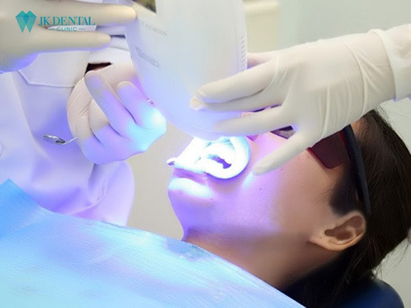 Giải đáp các câu hỏi về tẩy trắng răng tại Phòng khám nha khoa thẩm mỹ JK Dental - 4