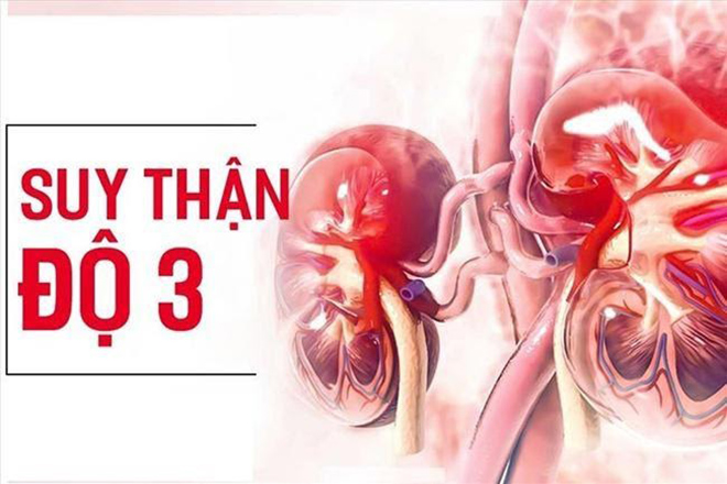 Suy thận độ 3 là giai đoạn bệnh có chuyển biến nặng