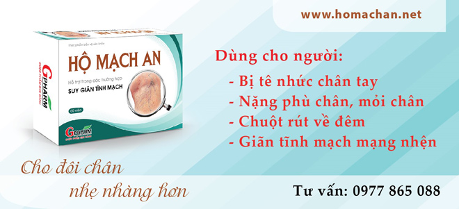Ngồi vắt chéo chân – thói quen gây suy giãn tĩnh mạch - 3