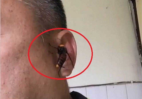 Con ong bắp cày bám vào phần tai của ông Chang. Ảnh: Taiwan News