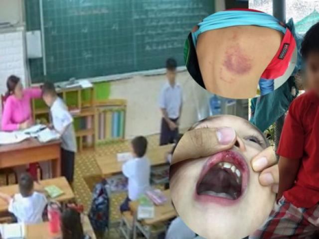 Giáo dục - du học - Những sai lầm thường gặp của giáo viên khi học sinh mắc lỗi