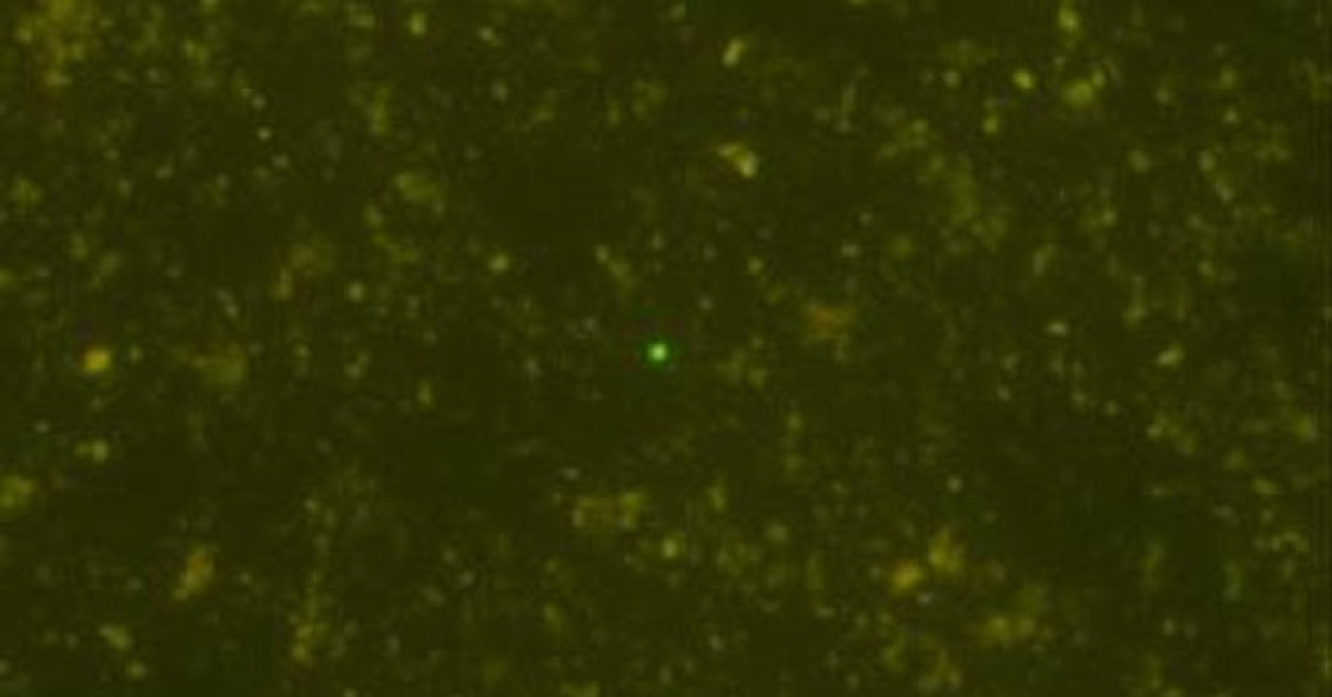 Hình ảnh trên kính hiển vi cho thấy các vi sinh vật bí ẩn trong lõi trầm tích - Ảnh: JAMSTEC/IODP