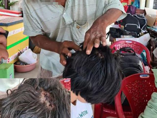 Tin tức trong ngày - Tin tức 24h qua: Nữ sinh bị đánh dã man sau va chạm giao thông vẫn rất hoảng sợ