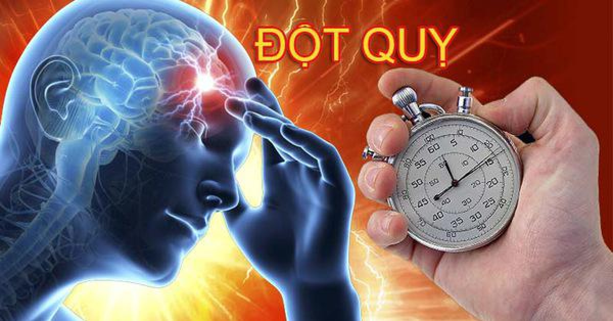 Sức khỏe đời sống - Những người có nguy cơ đột quỵ cao, nếu bạn trong nhóm này cần hết sức cảnh giác