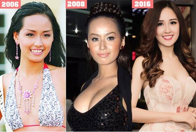 Trong một bài phỏng vấn gần đây, Mai Phương Thúy thừa nhận bản thân có nhờ tới thẩm mỹ để đẹp hơn so với quá khứ. Cô nói: "Phẫu thuật thẩm mỹ có chứ. Nhưng mà nói ra luôn lại mất hay à? Thôi, để mọi người đoán đi, nó nằm ở trong khung hình này thôi".