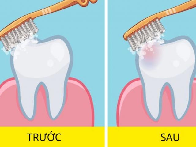 Sức khỏe đời sống - Nên đánh răng trước hay sau ăn sáng? Câu hỏi "muôn thuở" được chuyên gia giải đáp