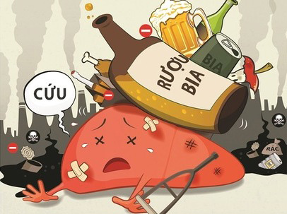 Bia rượu - tăng gánh nặng cho gan