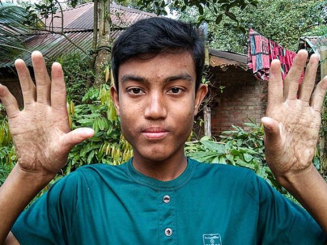 Phi thường - kỳ quặc - Gia đình 3 đời đàn ông không có vân tay, khốn khổ vì đi đâu cũng gặp rắc rối