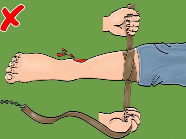 Sức khỏe đời sống - 10 sai lầm khi sơ cứu có thể gây nguy hiểm cho tính mạng