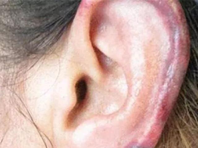 Sức khỏe đời sống - Quý ông cẩn trọng với “2 đen 2 mùi” này trên cơ thể, dấu hiệu cho thấy thận đang "kêu cứu"