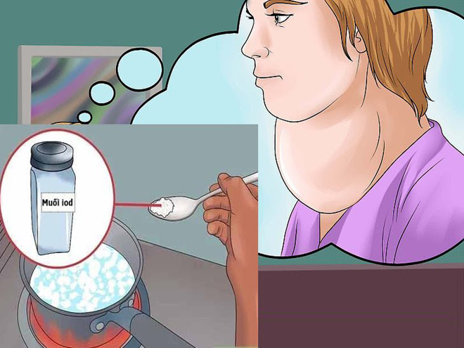 Nguyên nhân chủ yếu gây bướu cổ đơn thuần là do sự thiếu hụt iod