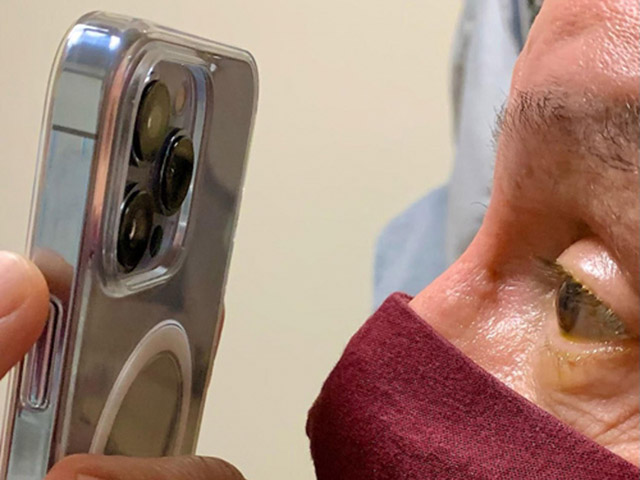 Thời trang Hi-tech - Bác sỹ dùng chiếc iPhone này để khám mắt cho bệnh nhân