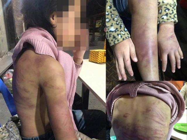 Pháp luật - Bé gái 12 tuổi ở Hà Nội bị bạo hành, xâm hại: Cha dượng và mẹ ruột lĩnh án