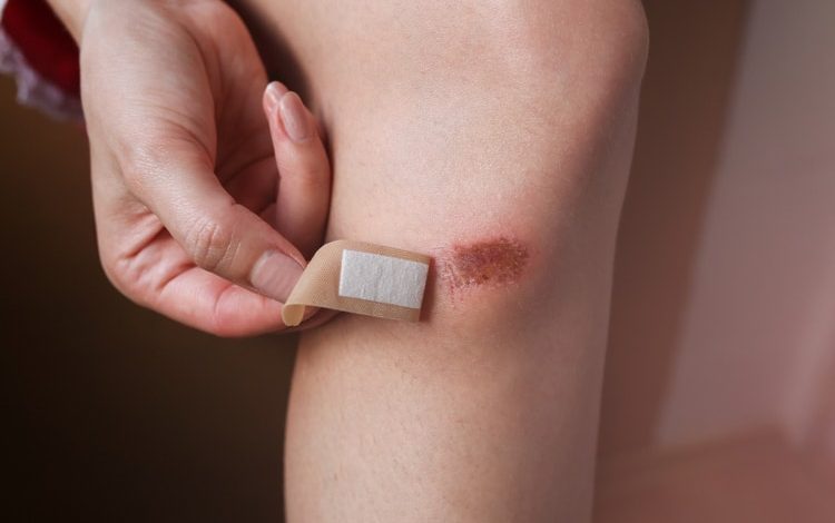 Những tín hiệu “báo động” gan của bạn đang gặp phải vấn đề - 2